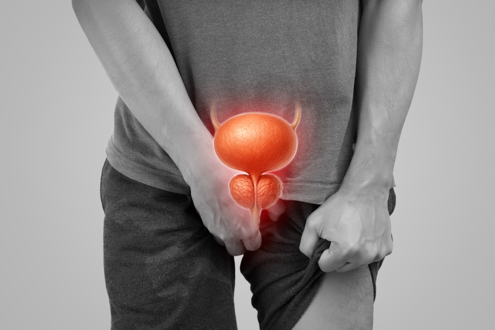 Prostat Büyümesi ile Prostat Kanseri Arasındaki Fark Nedir?