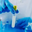 Sperm DNA Hasarı ve DNA Fragmentasyon Testi