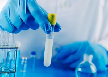 Sperm DNA Hasarı ve DNA Fragmentasyon Testi