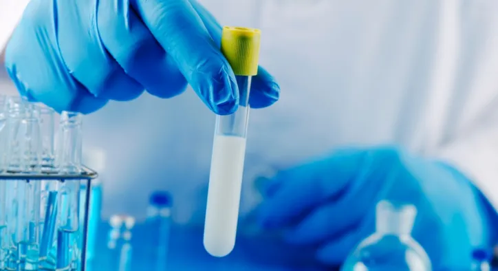 Sperm DNA Hasarı ve DNA Fragmentasyon Testi