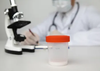 Sperm Testi Sonuçları Nasıl Yorumlanır?